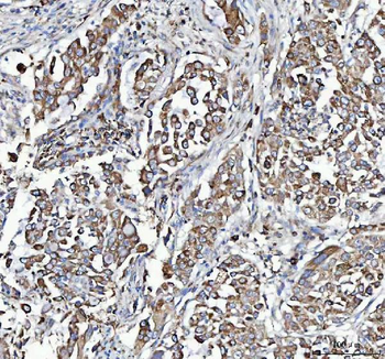 C19orf10/MYDGF Antibody