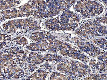 MOCS2 Rabbit Polyclonal Antibody