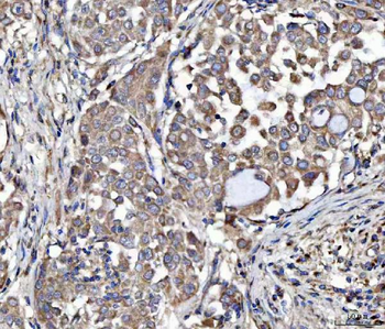 MOCS2 Rabbit Polyclonal Antibody