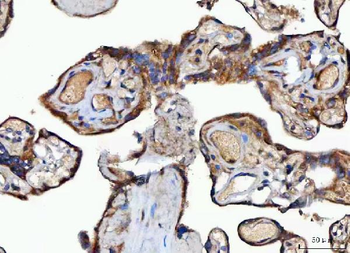 MOCS2 Rabbit Polyclonal Antibody