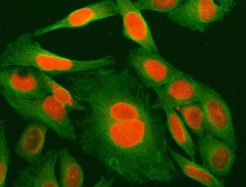 MED29 Rabbit Polyclonal Antibody