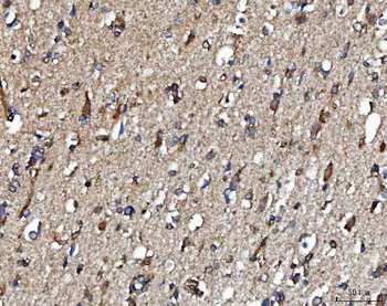 METAP2 Rabbit Polyclonal Antibody