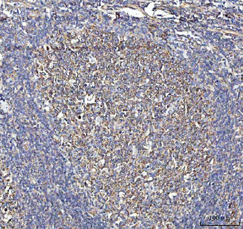METAP2 Rabbit Polyclonal Antibody