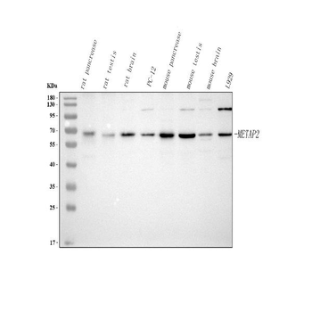 METAP2 Rabbit Polyclonal Antibody
