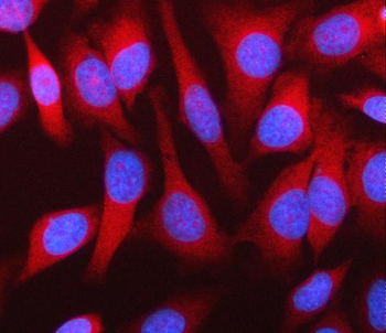 MPHOSPH9 Rabbit Polyclonal Antibody