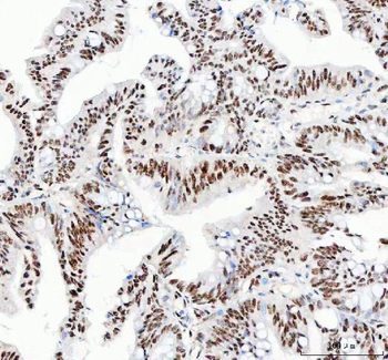NUCKS1 Antibody