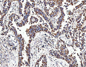 MOCS1 Rabbit Polyclonal Antibody