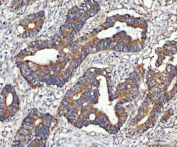 MOCS1 Rabbit Polyclonal Antibody