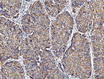 MOCS1 Rabbit Polyclonal Antibody