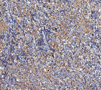 MOCS1 Rabbit Polyclonal Antibody
