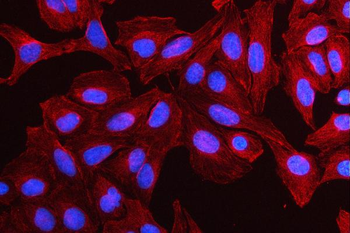MMP19 Rabbit Polyclonal Antibody