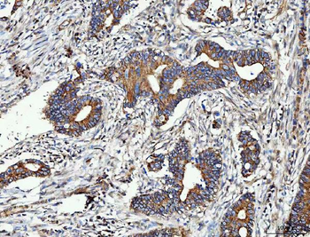 MMP19 Rabbit Polyclonal Antibody
