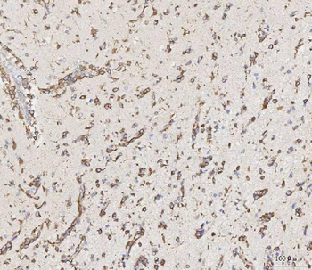 MMP19 Rabbit Polyclonal Antibody