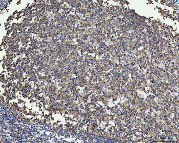 MMP19 Rabbit Polyclonal Antibody