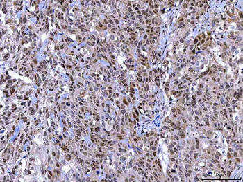 MAGED4 Rabbit Polyclonal Antibody
