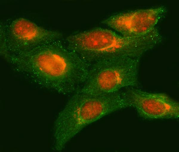 METTL11A/NTMT1 Rabbit Polyclonal Antibody
