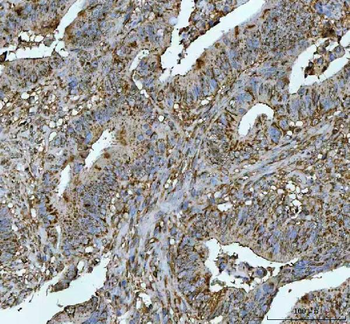 METTL11A/NTMT1 Rabbit Polyclonal Antibody