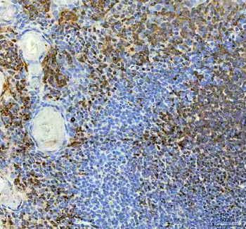 METTL11A/NTMT1 Rabbit Polyclonal Antibody