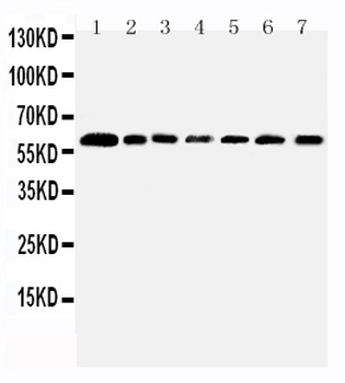 PRMT4/CARM1 Rabbit Polyclonal Antibody