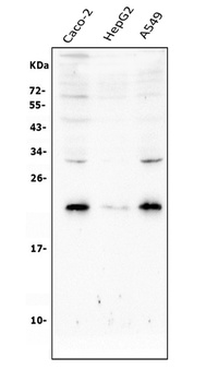 Ras-related protein Rab-8A RAB8A/8A Rabbit Polyclonal Antibody