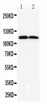 TMEM16A/ANO1 Rabbit Polyclonal Antibody