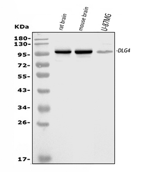 PSD95/DLG4 Rabbit Polyclonal Antibody