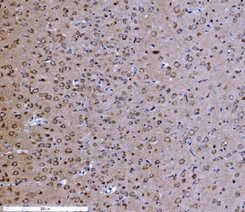PSD95/DLG4 Rabbit Polyclonal Antibody