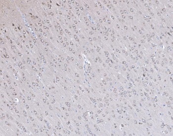 PSD95/DLG4 Rabbit Polyclonal Antibody