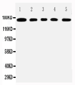 Mucin-1 MUC1 Rabbit Polyclonal Antibody