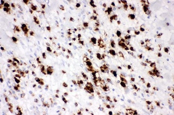 Mucin 5AC/MUC5AC Rabbit Polyclonal Antibody