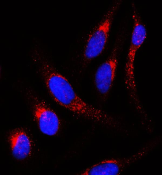 APLP2 Rabbit Polyclonal Antibody
