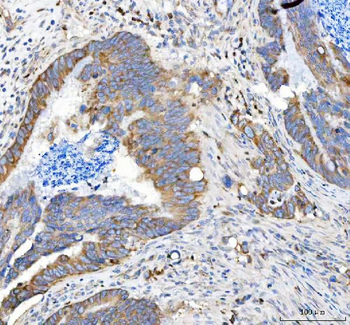 APLP2 Rabbit Polyclonal Antibody