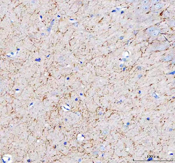 APLP2 Rabbit Polyclonal Antibody