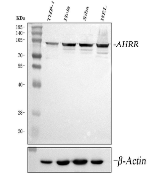 AHRR Rabbit Polyclonal Antibody