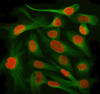 AHRR Rabbit Polyclonal Antibody