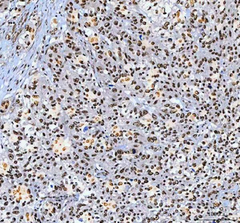 AHRR Rabbit Polyclonal Antibody