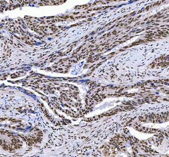 AHRR Rabbit Polyclonal Antibody