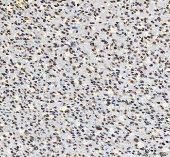 AHRR Rabbit Polyclonal Antibody