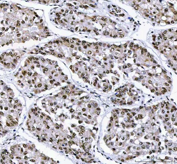 AHRR Rabbit Polyclonal Antibody