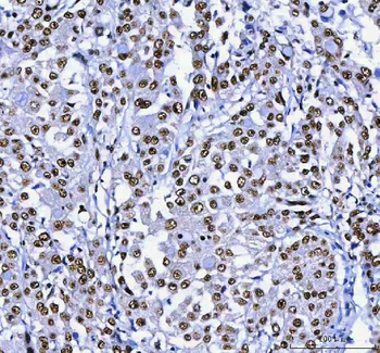 AHRR Rabbit Polyclonal Antibody