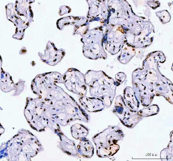 AHRR Rabbit Polyclonal Antibody