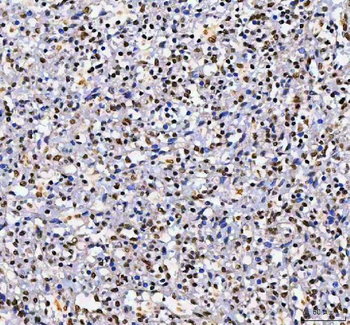 AHRR Rabbit Polyclonal Antibody