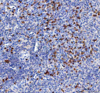 MIP-3 Beta/CCL19/MIP Rabbit Polyclonal Antibody