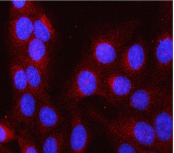 LAP3 Rabbit Polyclonal Antibody