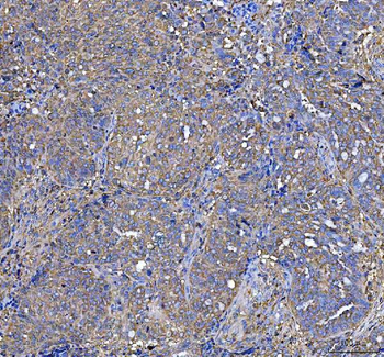 LAP3 Rabbit Polyclonal Antibody