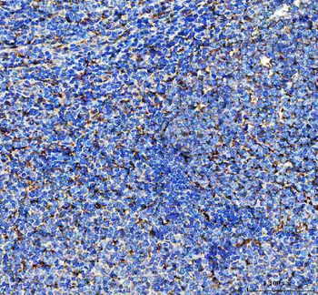 LAP3 Rabbit Polyclonal Antibody