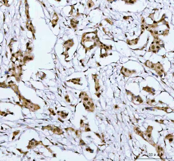 PSIP1 Rabbit Polyclonal Antibody