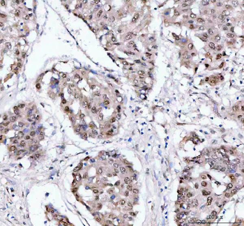 PSIP1 Rabbit Polyclonal Antibody