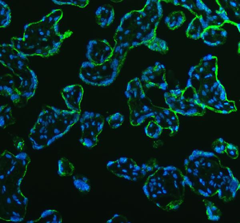 AGL Rabbit Polyclonal Antibody