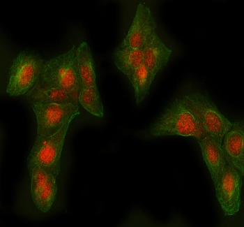 AGL Rabbit Polyclonal Antibody